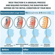 Cervical Neck Stretcher with 8 Airbags & Triple Traction